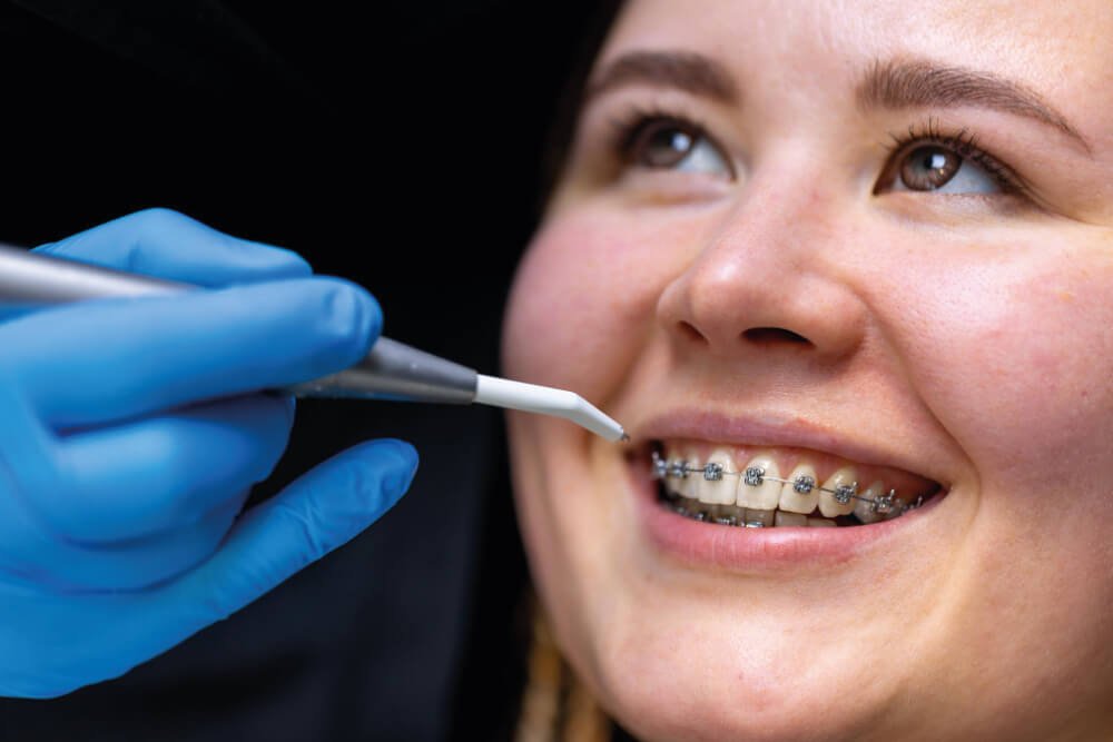 ¿Qué es la Ortodoncia?